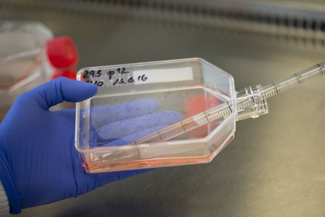 Zellkulturen "in vitro" (im Reagenzglas) sind eine wichtige Ergänzungs- und Ersatzmethode für Tierversuche. Foto: Karin Tilch 