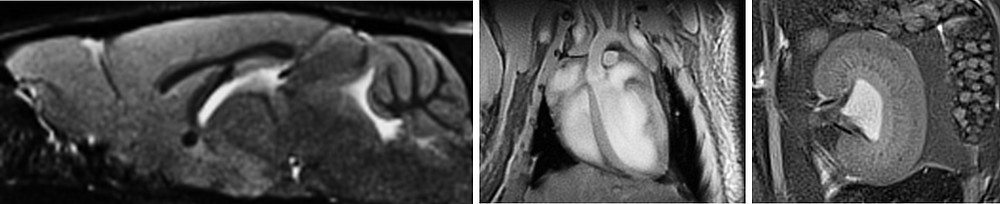 Hochaufgelöste MRT-Schnittbilder des (links) Gehirns (Auflösung: 100 x 100 x 100 µm3), (Mitte) des Herzens (175 x175 x 300 µm3) und (rechts) der Niere (125 x 125 x 400 µm3) einer Maus. Aufnahmen: Susann Boretius