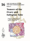 Tumors of the Ovary and the Fallopian Tube