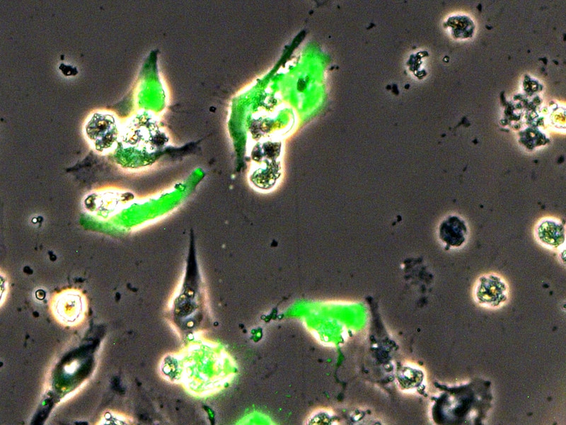 Das grün fluoreszierende Protein ist unter dem Mikroskop gut zu erkennen.