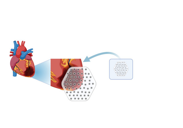Schematische Darstellung der Anwendung eines Herzpflasters. Abbildung: Bobbie Smith