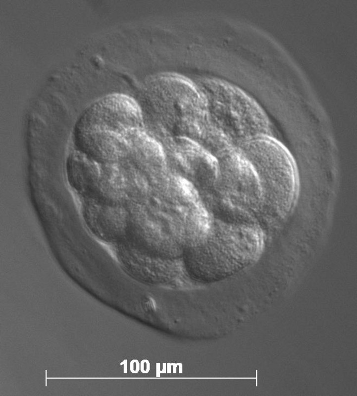 Ein etwa 4 Tage alter Präimplantationsembryo des Weißbüschelaffen im so genannten Morula- oder Maulbeerkeim-Stadium. Foto: Edgar Vogt