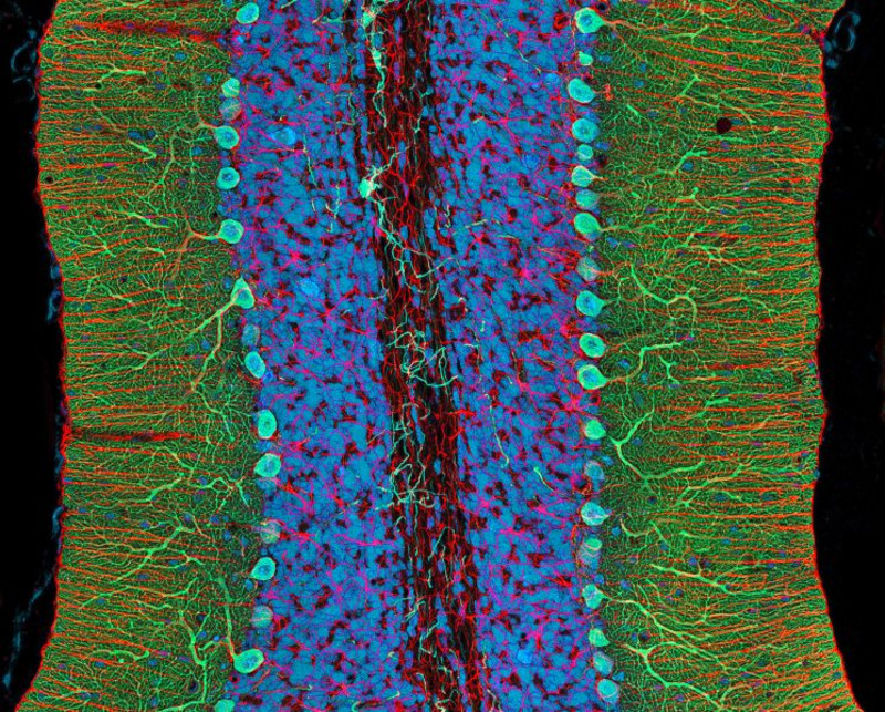 Mit Hilfe der In-Situ-Hybridisation ist es möglich tiefer in Zellgewebe zu schauen als mit dem Mikroskop. Sie dient vor allem dazu, RNA und DNA in Geweben oder einzelnen Zellen nachzuweisen. Bild: Thomas Deerinck, Mark Ellisman