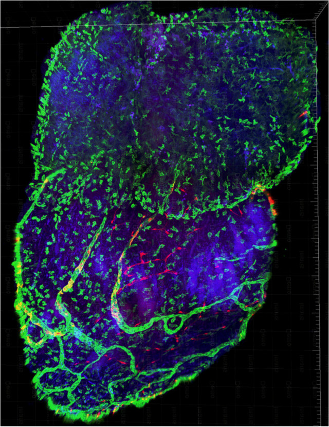 Herz einer neugeborenen Maus, das noch seine Regenerationsfähigkeit besitzt. Das Bild zeigt Zellen des Immunsystems und der koronaren Gefäßversorgung, die beide für die Herzregulation relevant sind. Foto: CNIC
