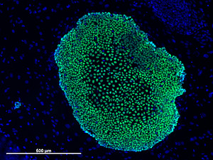 Proteins such as OCT4 (pictured colored green) play a crucial role  in embryonic stem cells. Photo: Katharina Debowski