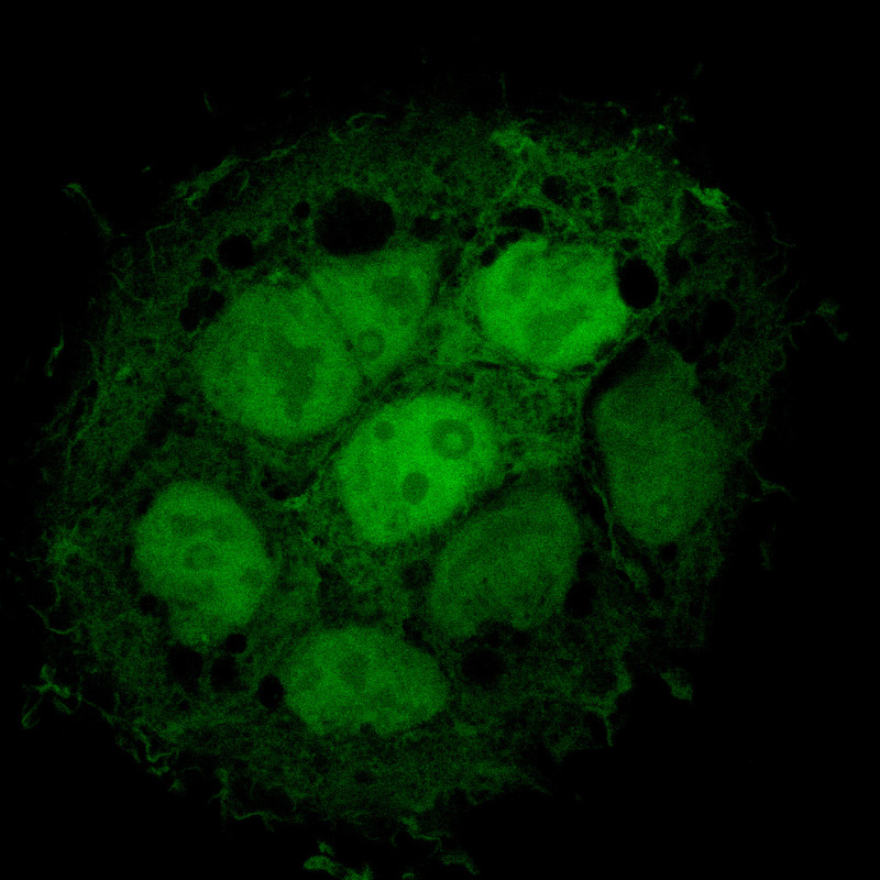 Die durch künstliche Viruspartikel infizierten Zellen lassen sich leicht durch die Bildung eines unter UV-Licht grün fluoreszierenden Proteins identifizieren. Aufnahme: Heike Hofmann-Winkler.