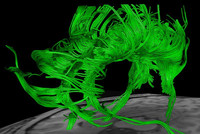 Das Bild zeigt eine Fasertraktographie des Cingulum im gesunden menschlichen Gehirn. Das Cingulum ist ein großes Faserbündel dicht über dem Corpus callosum (weisser Balken) entlang des Hemisphärenspaltes. Abbildung: Sabine Hofer