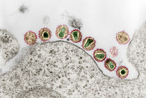 The HI-virus under an electron microscope. Image: Hans R. Gelderblom. Coloration: Andrea Schnartendorff/RKI