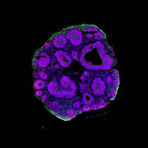 Ein Hirnorganoid (Mensch) besteht aus einer dreidimensionalen Struktur unterschiedlicher Hirnzellen. Magenta: Vorläuferzellen; Grün: Neurone; Blau: Zellkerne. Foto: Michael Heide