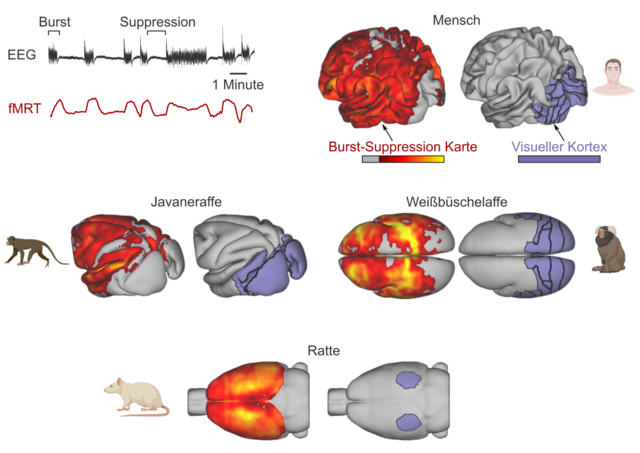 Burst-Supression in EEG und fMRT von Menschen, Javaneraffen, Weißbüschelaffen und Ratten. Abbildung: Nikoloz Sirmpilatze