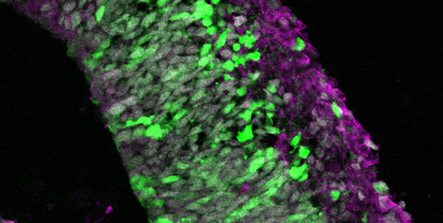 Ausschnitt eines elektroporierten Hirnorganoiden eines Weißbüschelaffen. Grün: elektroporierte Zellen, die durch das grün fluoreszierende Protein grün leuchten; Magenta: Nervenzellen; Grau: Zellkerne. Foto: Lidiia Tynianskaia