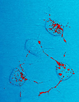 Four mouse nerve cells. The infectivity of the prion proteins (red) is clearly visible in the movement of the proteins along the neurites directing to neighboring cells. Photo: NIAID