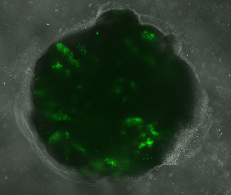 Elektroporierter menschlicher Hirnorganoid. Grün: Zellen mit grün fluoreszierendem Protein. Foto: Lidiia Tynianskaia