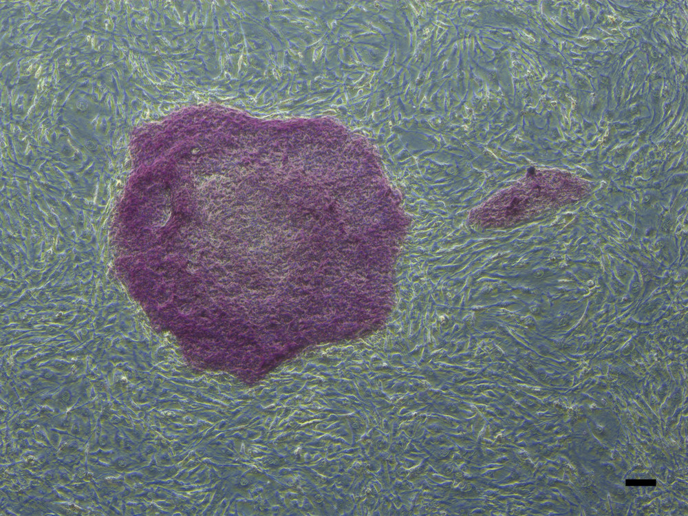 Eine Kolonie induzierter pluripotenter Stammzellen des Rhesusaffen in Kultur (rot). Den Nachweis, dass es sich tatsächlich um pluripotente Zellen handelt, liefert die rote Farbe der Zellen. Nur pluripotente Stammzellen haben ein Enzym, das einen zunächst unsichtbaren Stoff in roten Farbstoff umwandeln kann. Die Stammzellkolonie hat einen Durchmesser von etwas mehr als einem Millimeter und besteht aus einigen hundert Stammzellen. Im Hintergrund sind Nicht-Stammzellen zu sehen, die dementsprechend nicht angefärbt sind. Die Nicht-Stammzellen dienen der Unterstützung der Stammzellen und halten diese in ihrem Alleskönner-Stammzellzustand. Foto: Ignacio Rodriguez-Polo