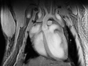 The heart of a mouse in MRI. Photo: Susann Boretius