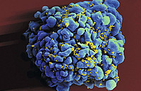 Das Bild zeigt eine rasterelektronenmikroskopische Aufnahme einer HIV-infizierten menschlichen H9-T-Zelle. Bild: NIAID-NIH, https://www.flickr.com/photos/niaid/6813396647/in/gallery-ngscott-72157657145444441/, https://creativecommons.org/licenses/by/2.0/