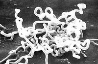 Eine Kultur des Bakteriums Treponema pallidum. Foto: David Cox, by Photo Credit: Content Providers(s): CDC/ Dr. David Cox [Public domain], via Wikimedia Commons