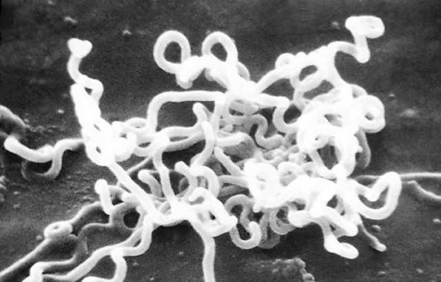 Eine Kultur des Bakteriums Treponema pallidum. Foto: David Cox, by Photo Credit: Content Providers(s): CDC/ Dr. David Cox [Public domain], via Wikimedia Commons