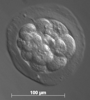Embryo eines Weißbüschelaffen im Morulastadium. Foto: Edgar Vogt