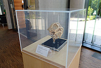 Menschlicher Schädel mit Blick auf die äußere Hirnhaut (Dura mater). Foto: Sylvia Siersleben