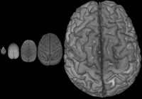 Diese Bilder zeigen MRT-Aufnahmen von Gehirnen unterschiedlicher Größe und Komplexität von „Maus bis Mensch“. Die Oberflächenrekonstruktionen zeigen neben der klaren Größenzunahme auch eine deutliche Zunahme der Faltung. Abbildung: Jürgen Baudewig