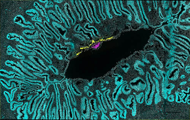Embryo eines Weißbüschelaffen in der Gebärmutter (türkis). Die Embryonalscheibe, die den Fötus bilden wird, und die Fruchtblase sind in pink dargestellt. Gelb eingefärbt ist die frühe Plazenta als Verbindung zwischen Embryo und Mutter. Foto: University of Cambridge