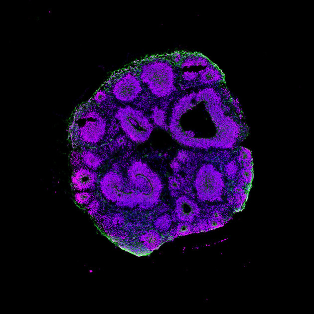 Ein Hirnorganoid (Mensch) besteht aus einer dreidimensionalen Struktur unterschiedlicher Hirnzellen. Magenta, Vorläuferzellen; grün, Neurone; blau, Zellkerne. Foto: Michael Heide