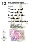Tumors and Tumor-Like Lesions of the Testis and Adjacent Tissues