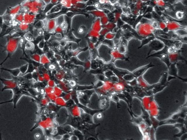 Menschliche HEK293-Zellen produzieren nach der Infektion mit CD9-haltigen Viren ein rot fluoreszierendes Reporterprotein (RFP), das die erfolgreiche Übertragung viraler Erbinformation in die Zellen anzeigt. Foto: Kai Böker