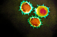 Elektronenmikroskopische Aufnahme des Coronavirus. Foto: AA+W - stock.adobe.com