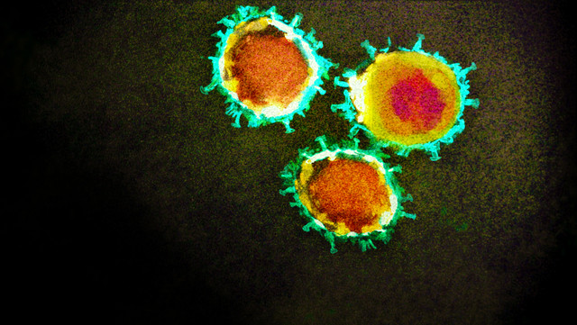 Elektronenmikroskopische Aufnahme des Coronavirus. Foto: AA+W - stock.adobe.com