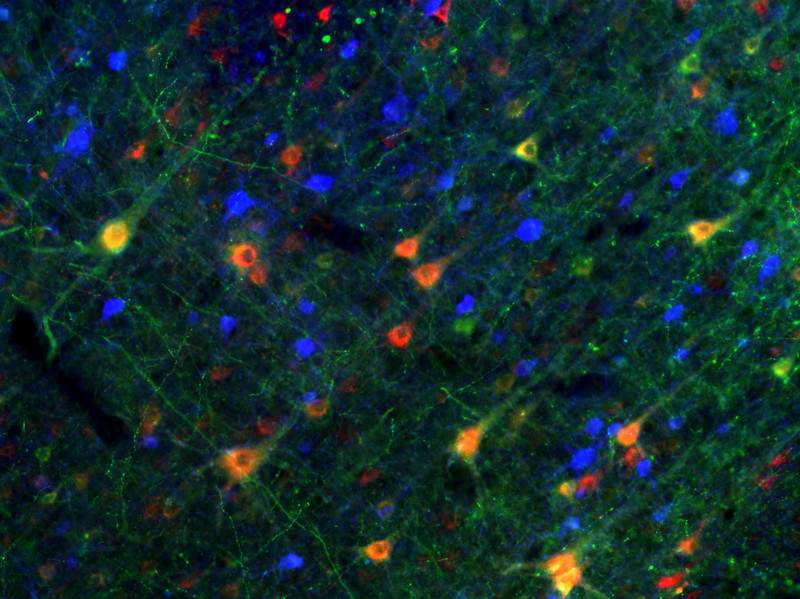 Angefärbte Nervenzellen im prämotorischen Kortex eines Rhesusaffen. Foto: Michal Fortuna