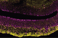 Ein Ausschnitt aus einem Hirnorganoid, das aus Stammzellen eines Menschen hergestellt wurde. In magenta sind sich aktiv vermehrende Hirnstammzellen zu sehen, in gelb eine Untergruppe von Hirnstammzellen. Foto: Jan Fischer