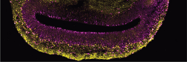 Ein Ausschnitt aus einem Hirnorganoid, das aus Stammzellen eines Menschen hergestellt wurde. In magenta sind sich aktiv vermehrende Hirnstammzellen zu sehen, in gelb eine Untergruppe von Hirnstammzellen. Foto: Jan Fischer