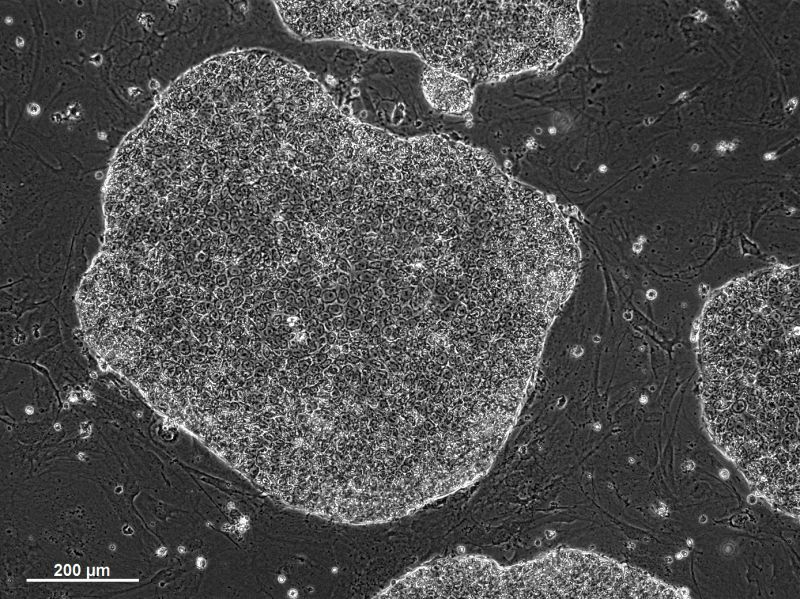 Eine Kolonie embryonaler Stammzellen des Weißbüschelaffen in pluripotentem Zustand. Die Stammzellen werden auf Nährzellen kultiviert. Foto: Katharina Debowski