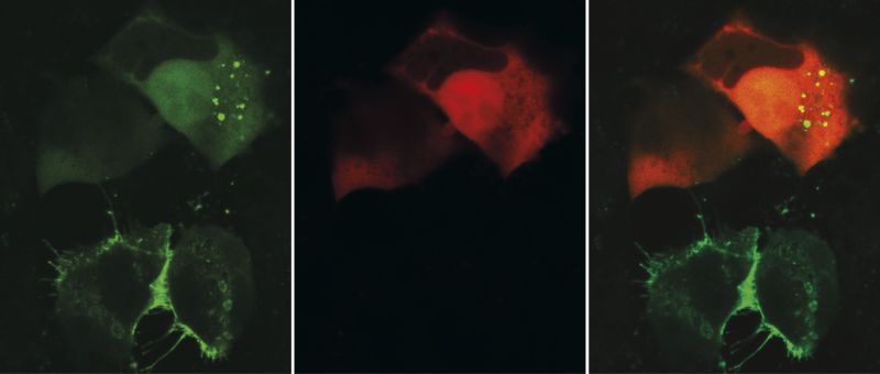 Das CD9-Protein wurde mit einem grün fluoreszierenden Protein (GFP) fusioniert, um es in den HEK293-Zellen zu lokalisieren (linke Abbildung). Foto: Kai Böker