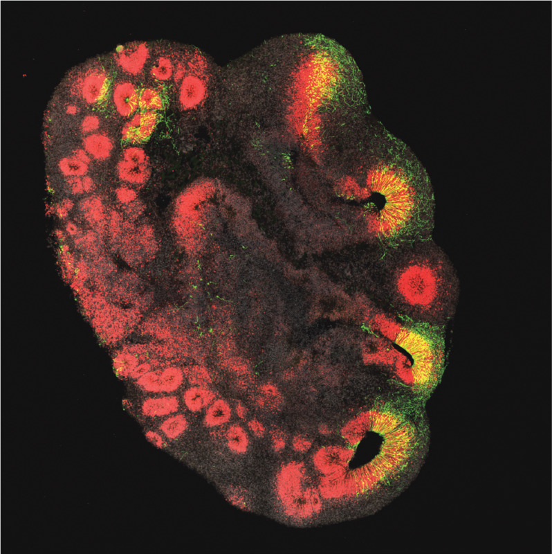 Ein etwa 3 Millimeter großes Hirnorganoid, das aus Stammzellen eines Schimpansen hergestellt wurde. Die Hirnstammzellen sind rot angefärbt, in grün sind Hirnstammzellen zu sehen, die das Gen ARHGAP11B erhalten haben. Foto: Jan Fischer