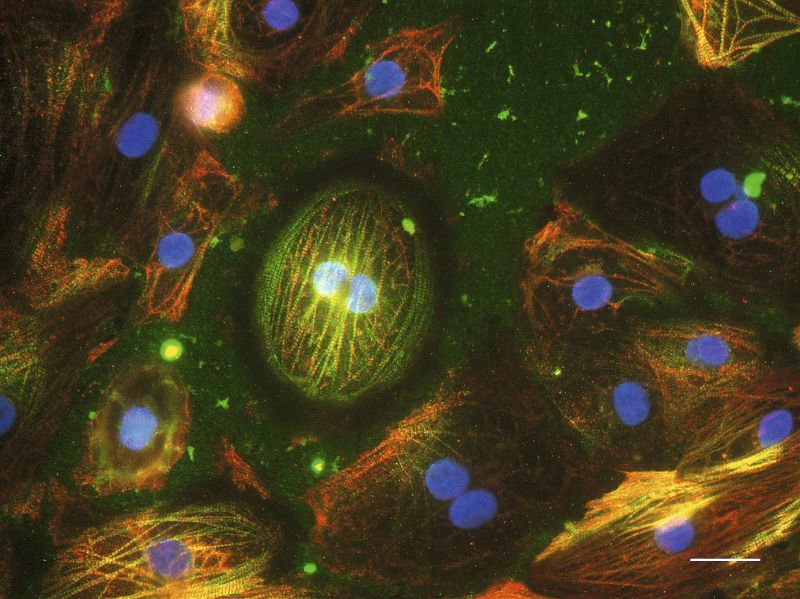 Eine Stammzelle spezialisiert sich zu einer Herzmuskelzelle, visualisiert mittels Immunfluoreszenzfärbung der Strukturproteine. Foto: Debbra Yasemin Knorr